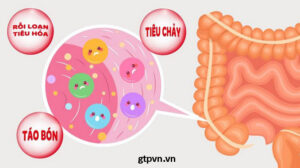 Nguyên nhân gây táo bón