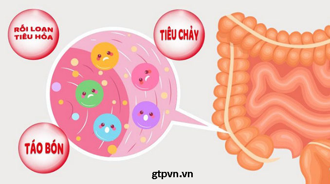 Nguyên nhân gây táo bón